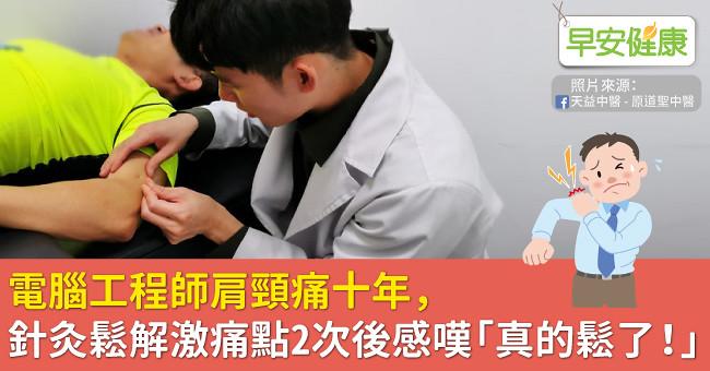 電腦工程師肩頸痛十年，針灸鬆解激痛點2次後感嘆「真的鬆了！」